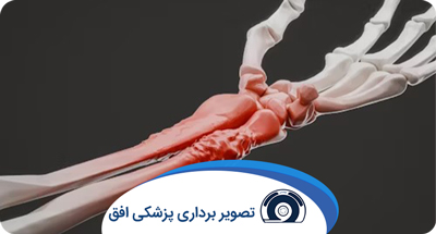 سنجش تراکم استخوان